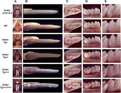 Overexpression of ameloblastin in secretory ameloblasts results in demarcated, hypomineralized opacities in enamel